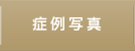 症例写真